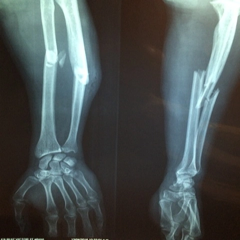 Orthopedic Surgery
